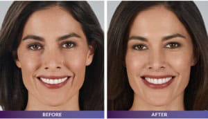 TVOS Dental Patient - Gallery