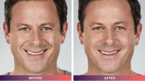 TVOS Dental Patient - Gallery