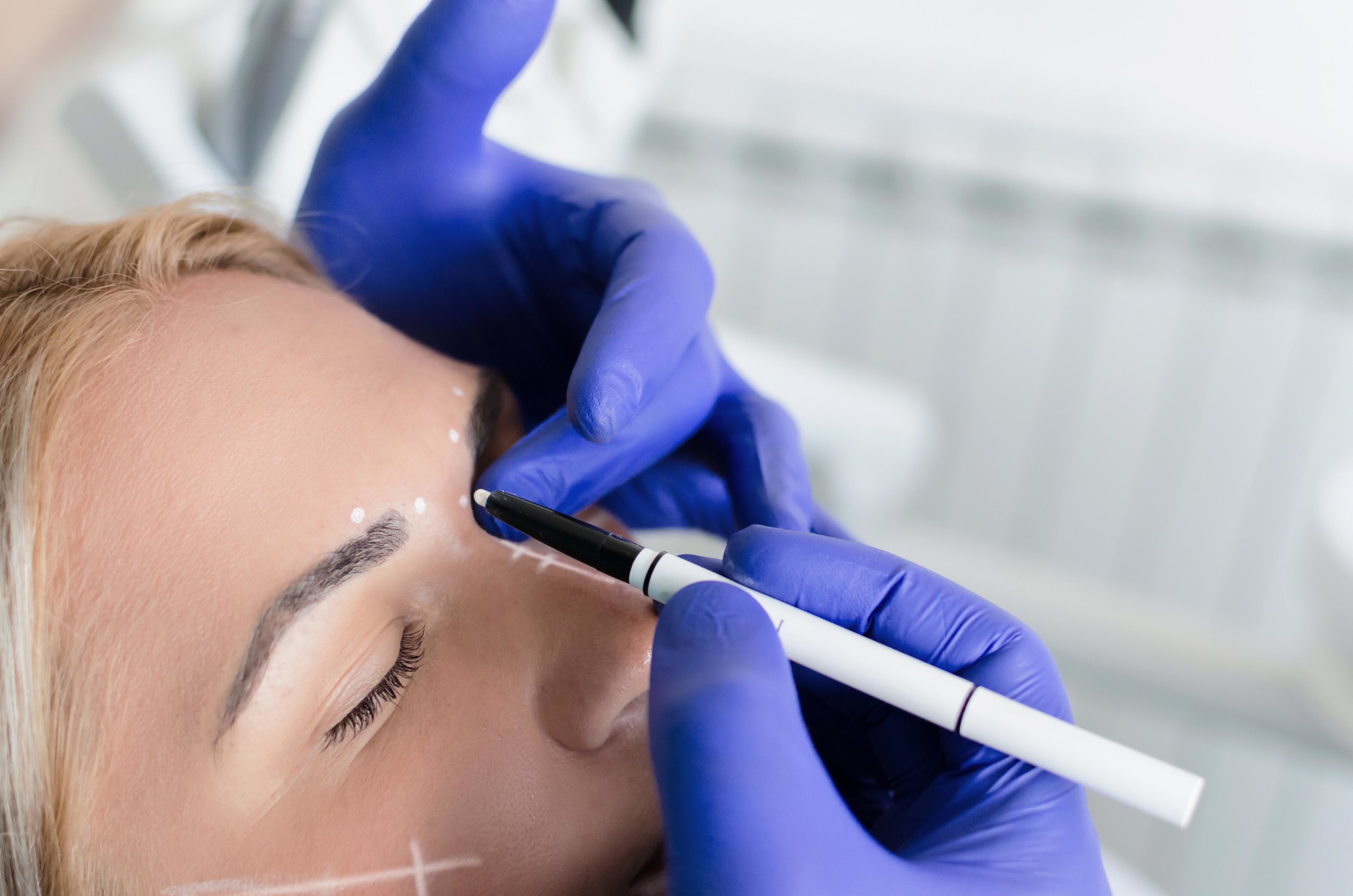 Surgical Brow Lifts