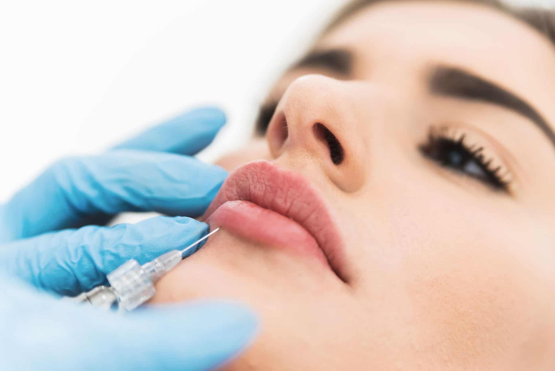 Lip Fillers And Lip Wrinkle Reduction Using Fillers And BOTOX® Cosmetic Lip Fillers And Lip Wrinkle Reduction Using Fillers And BOTOX® Cosmetic