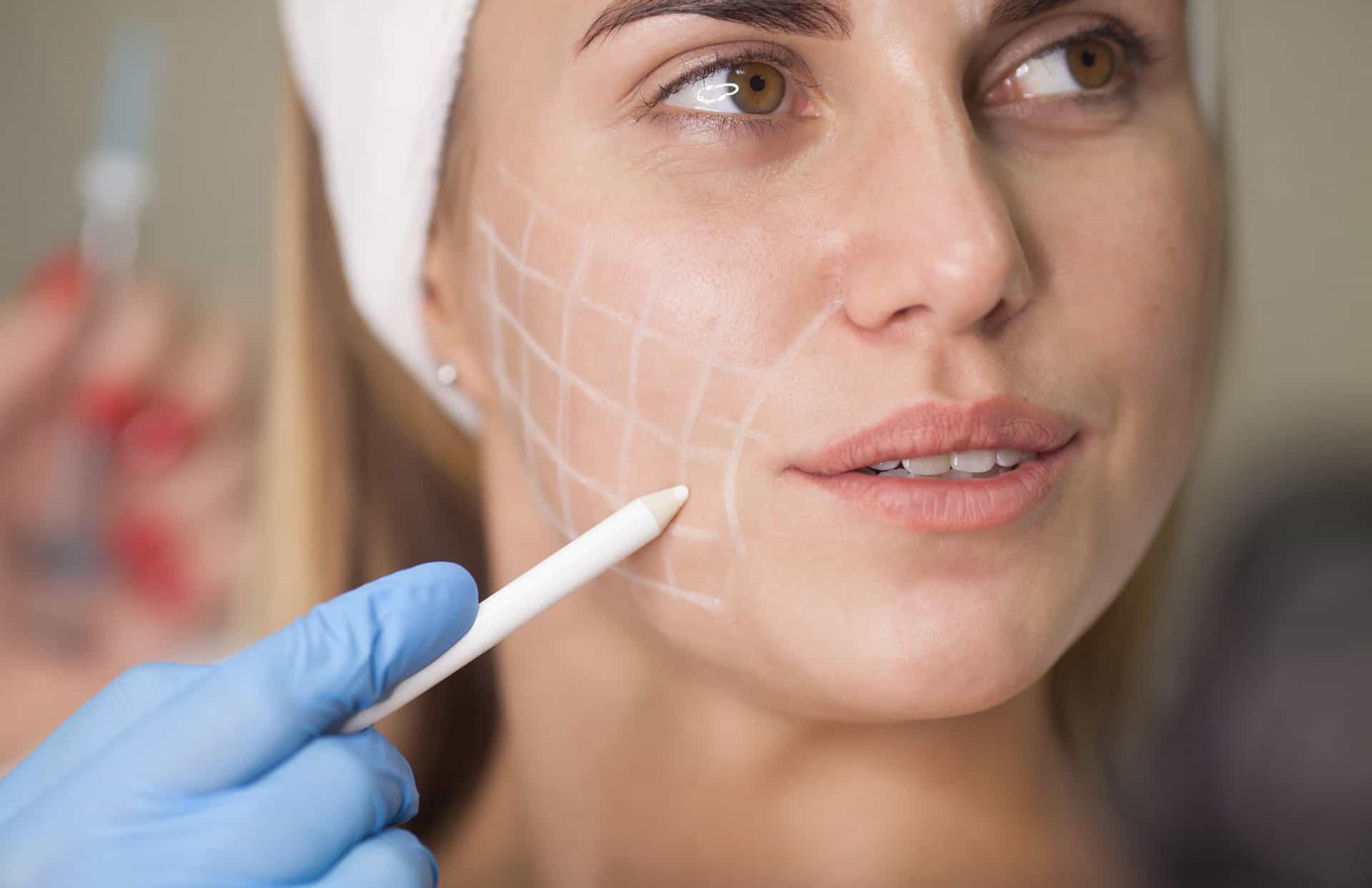 Cheek Filler Injections Cheek Filler Injections