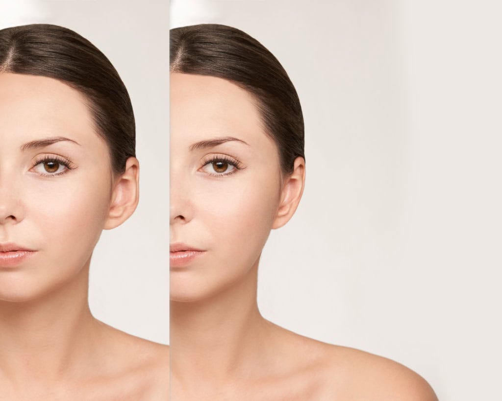 Otoplasty & Protruding Ears Otoplasty & Protruding Ears