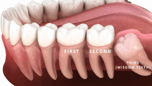 types of molars